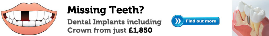 dental implants from £1,850