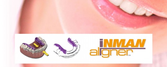 The Inman Aligner is a speedy way to straighten your teeth